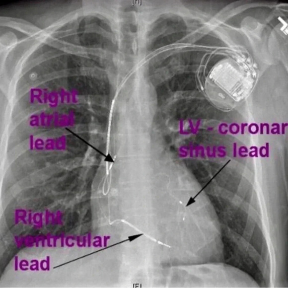 💔𝐇𝐞𝐚𝐫𝐭 𝐖𝐚𝐫𝐫𝐢𝐨𝐫💔 - Picture 5 of 10